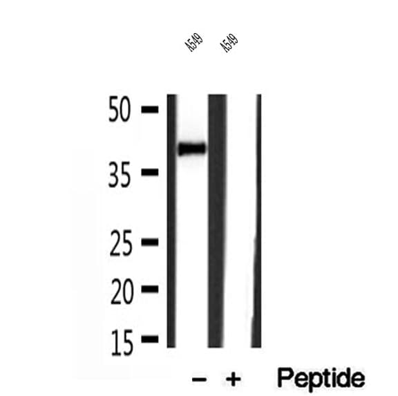IST1 Antibody
