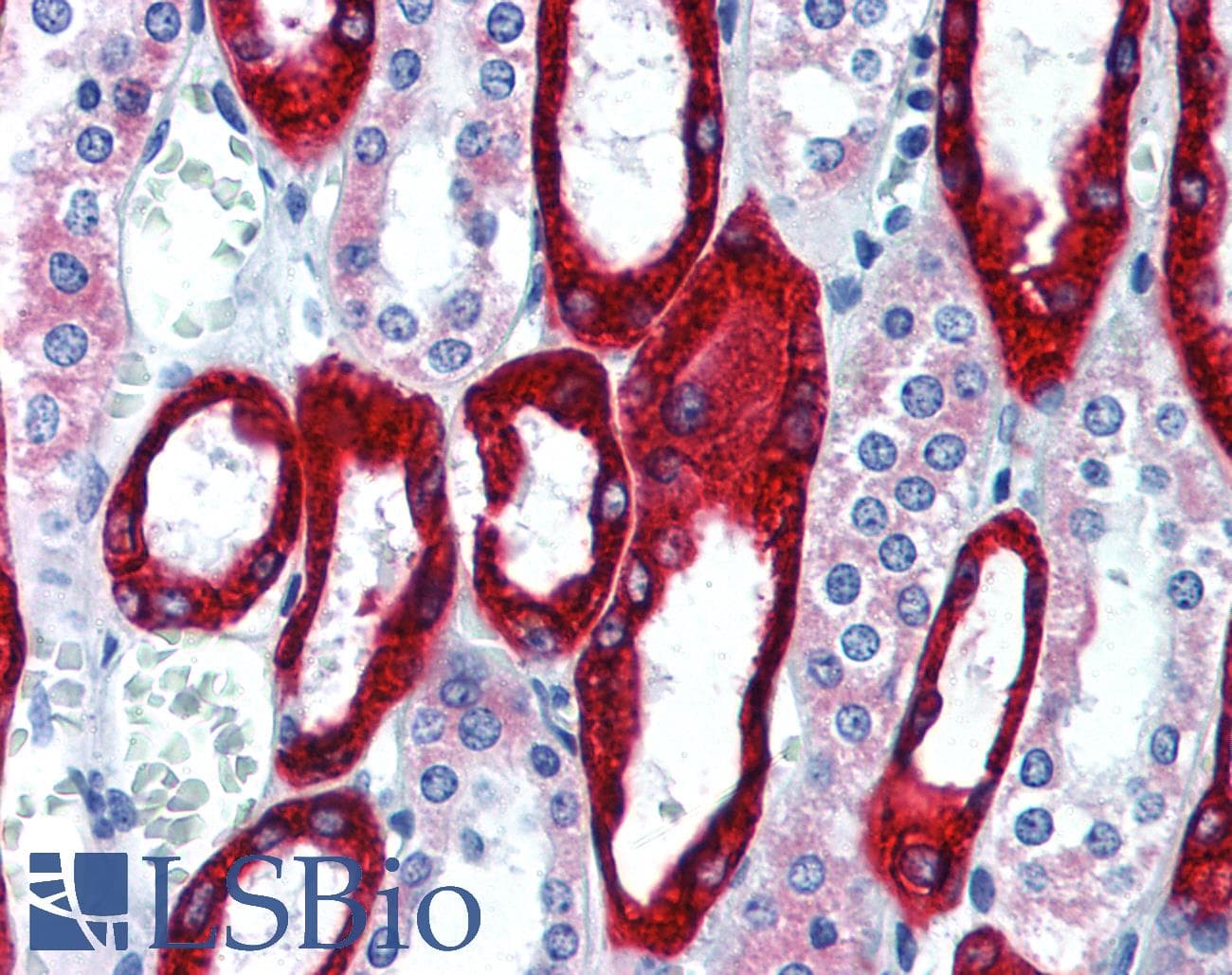 PathPlus™ Monoclonal Mouse anti-Human KRT19 / CK19 / Cytokeratin 19 Antibody (clone A53-B/A2, IHC, WB)