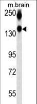 Monoclonal Mouse anti-Mouse NCAM / CD56 Antibody (aa830-858, WB)