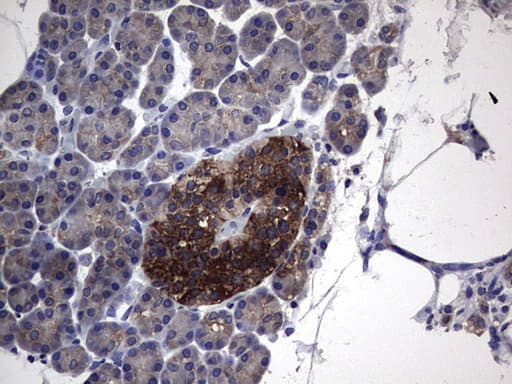 PKM2 Antibody (clone 1A1)