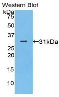 MYO1A Antibody (aa781-1043)