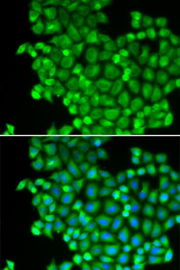 LDHA / LDH1 Antibody