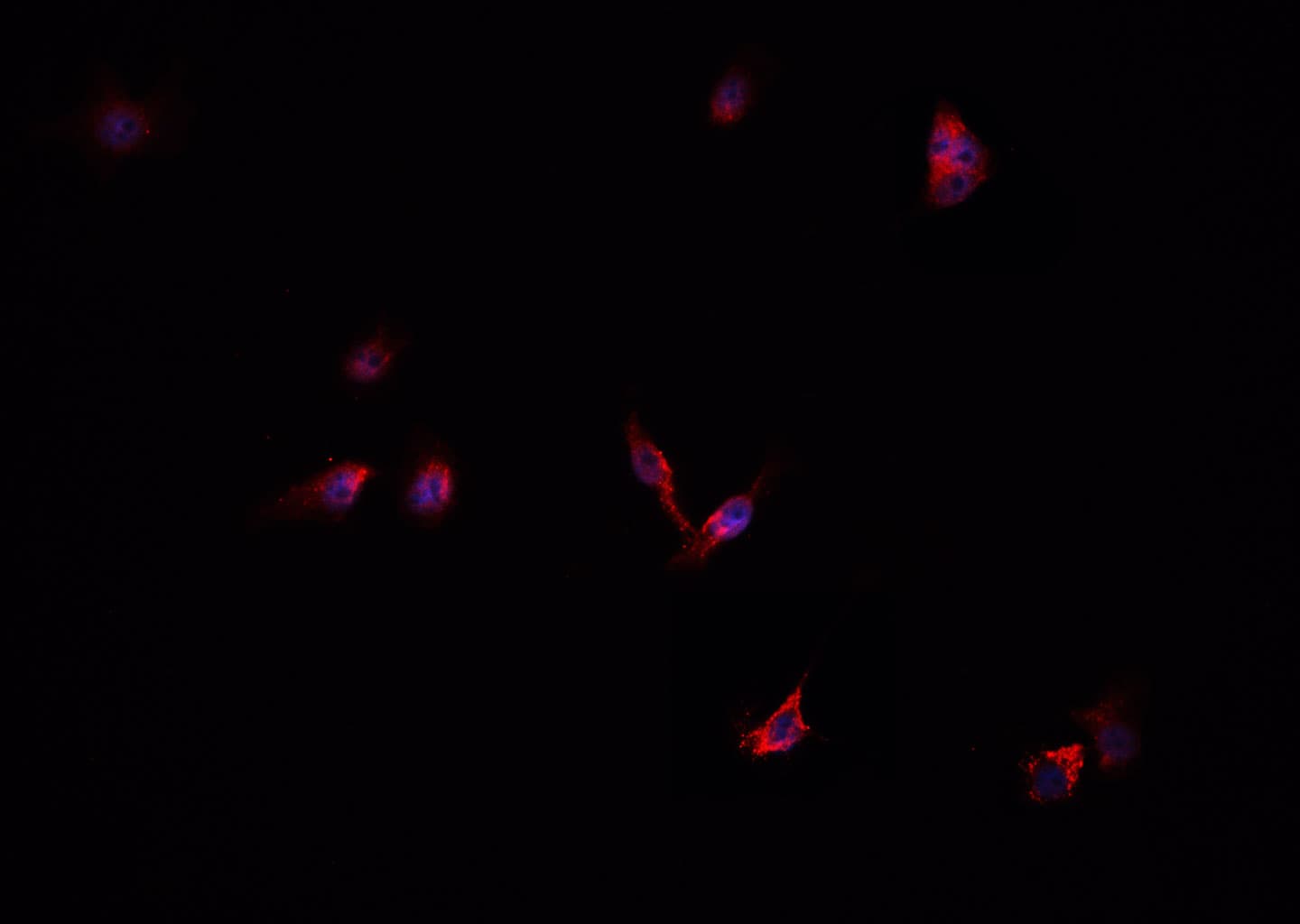 CFB / Complement Factor B Antibody