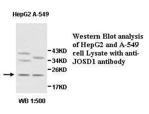 Polyclonal Rabbit anti-Human JOSD1 Antibody (aa44-188, IHC, WB)