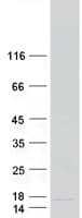 Human BRP44L Protein (Recombinant Myc-DDK (Flag))