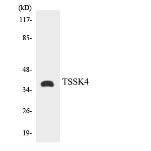 Polyclonal Rabbit anti-Human TSSK4 / TSSK5 Antibody (aa201-250, WB)
