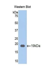 LGALS9 / Galectin 9 Antibody (aa17-147)