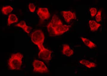 OR2A25 Antibody