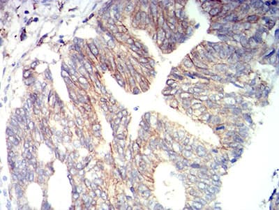 ALCAM / CD166 Antibody (clone 2F1B12)