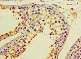 CALR3 Antibody (aa135-384)