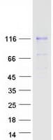Human MATN2 / Matrilin 2 Protein (Recombinant Myc-DDK (Flag))