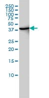 TRDMT1 / DNMT2 Antibody (clone 1E12)