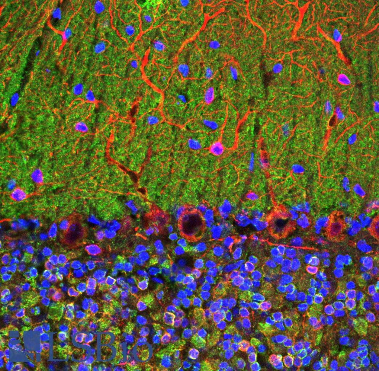 IHC-plus™ VILIP / VSNL1 Antibody (clone 3A9)