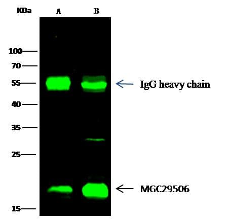 Polyclonal Rabbit anti-Human MZB1 Antibody (Preservative Free, IHC, WB)