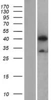 APG4B / ATG4B Protein (Over-Expression Lysate Myc-DDK (Flag))