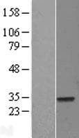 ELF5 Protein (Over-Expression Lysate Myc-DDK (Flag))