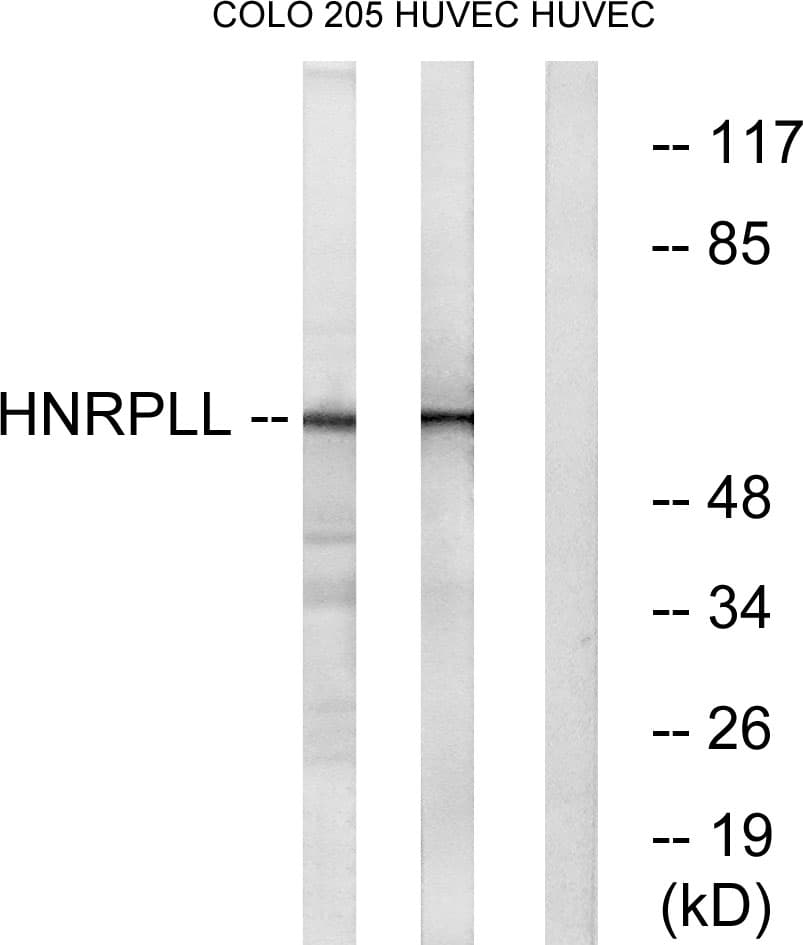 HnRNPLL / HNRPLL Antibody (aa241-290)
