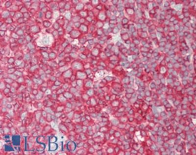PCSK9 Antibody (aa454-679)