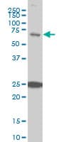 IHC-plus™ TRIM25 Antibody (clone 5C3)