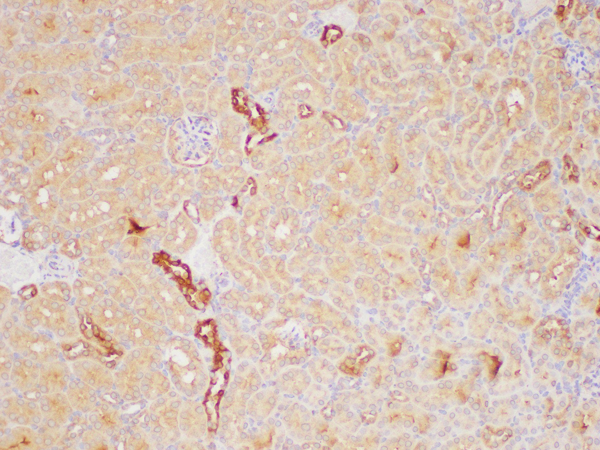 Polyclonal Rabbit anti-Human PAIP1 Antibody (IHC)