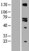 Human GLS2 / Glutaminase 2 Protein (Over-Expression Lysate Myc-DDK (Flag))