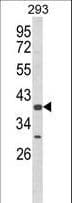 CSGALNACT2 Antibody (aa200-229)