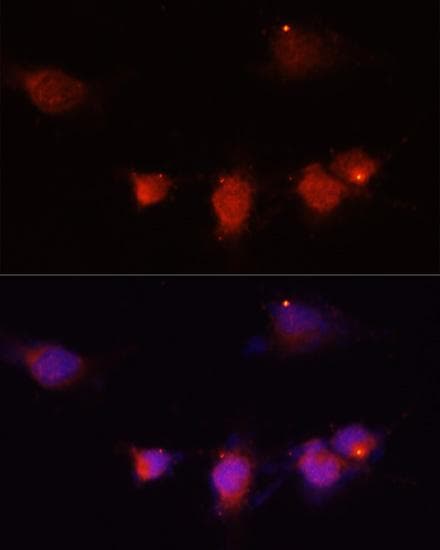 Neuropeptide Y / NPY Antibody