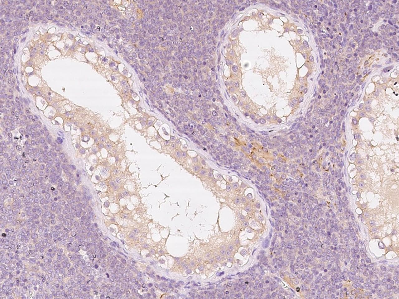 ANGEL1 Antibody