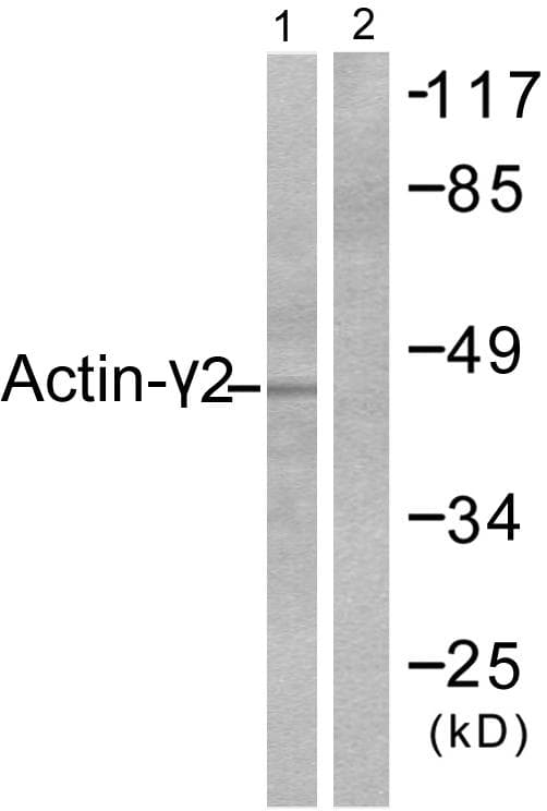 Polyclonal Rabbit anti-Human ACTG2 Antibody (IHC, WB)