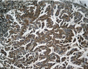 Polyclonal Rabbit anti-Human RELA / NFKB p65 Antibody (IHC, WB)