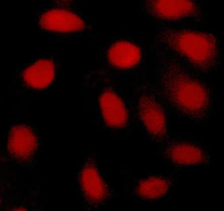 MYC / c-Myc Antibody