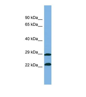 ZNF563 Antibody (aa151-200)