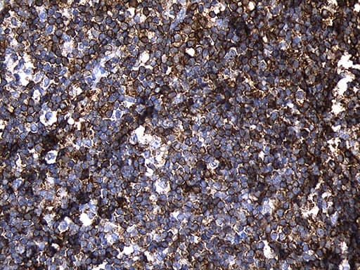 PLAC8 Antibody (clone OTI2E10)