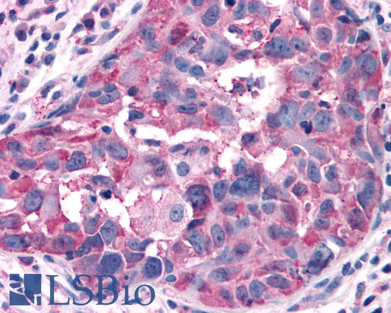 IHC-plus™ Polyclonal Rabbit anti-Human GPRC5A / RAI3 Antibody (Cytoplasmic Domain, IHC)