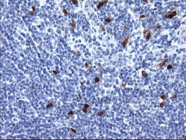Monoclonal Mouse anti-Human SERPINB2 / PAI-2 Antibody (clone OTI3H1, IHC, WB)