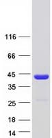 Human NACA Protein (Recombinant Myc-DDK (Flag))