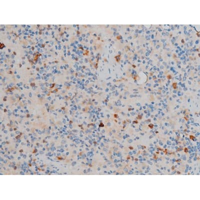CREB1 / CREB Antibody (phospho-Ser142)