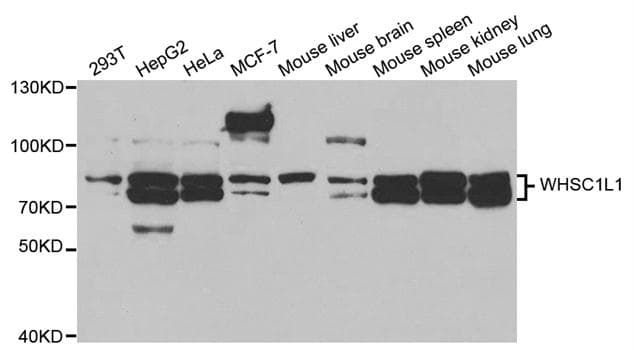 NSD3 / WHSC1L1 Antibody