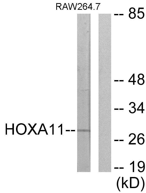 HOXA11+HOXD11 Antibody