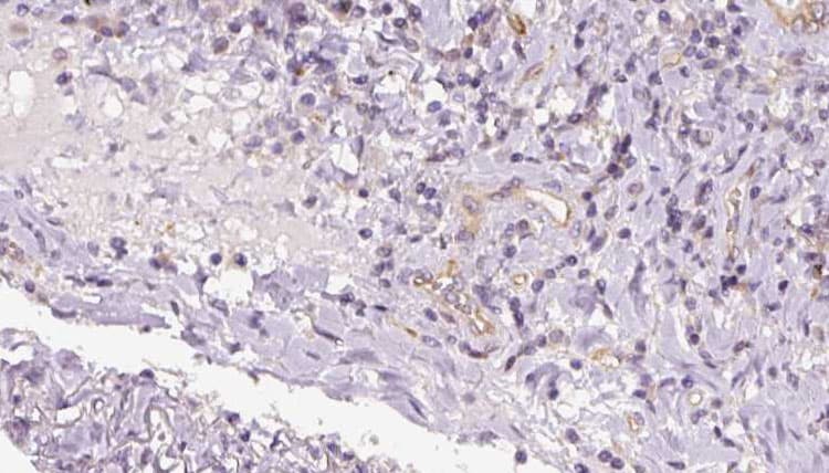Polyclonal Rabbit anti-Human TIMM17B Antibody (IHC, WB)