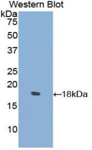 COL2A1 / Collagen II Alpha 1 Antibody (aa677-817)