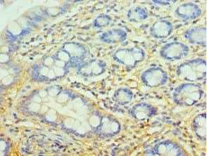 CFH / Complement Factor H Antibody (aa20-270)