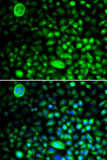 Polyclonal Rabbit anti-Human CACNG2 / Stargazin Antibody (IHC, IF, WB)