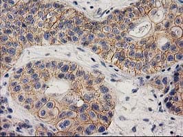 Monoclonal Mouse anti-Human EIF4E2 / IF4e Antibody (clone OTI1F2, IHC, WB)