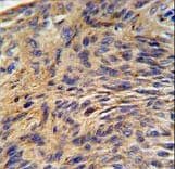HSPA5 / GRP78 / BiP Antibody (aa261-289)