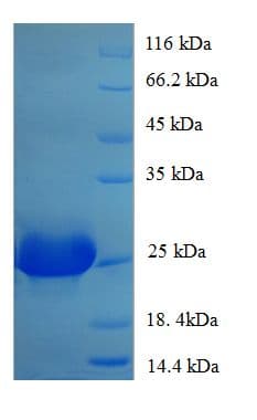 Human PVALB / Parvalbumin Protein (Recombinant His-SUMO)