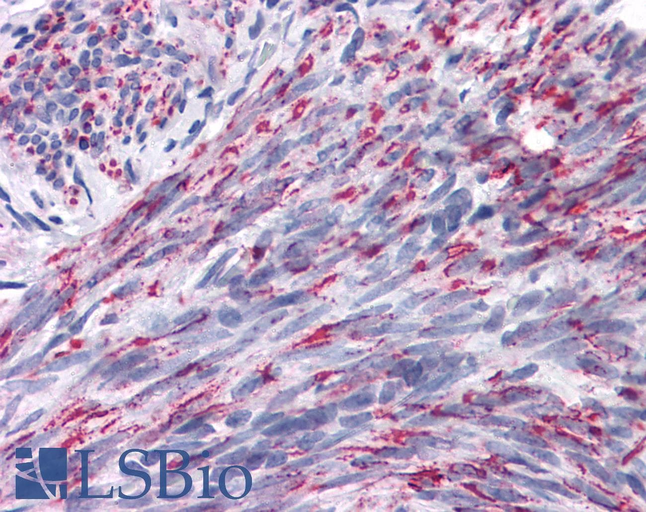 IHC-plus™ ANKRD54 / LIAR Antibody