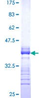 Human LMTK3 Protein (Recombinant GST, N-terminus)