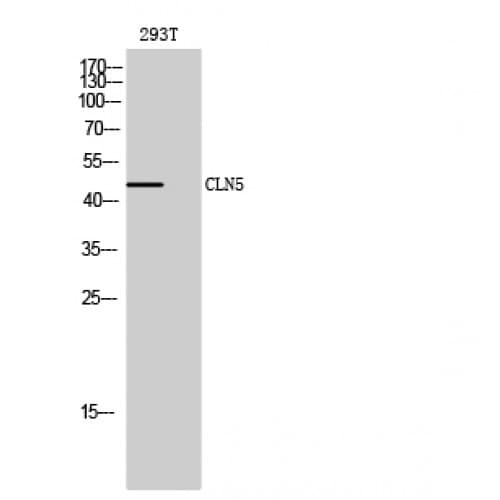 CLN5 Antibody (140-220 aa, Internal)