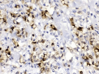 CA2 / Carbonic Anhydrase II Antibody